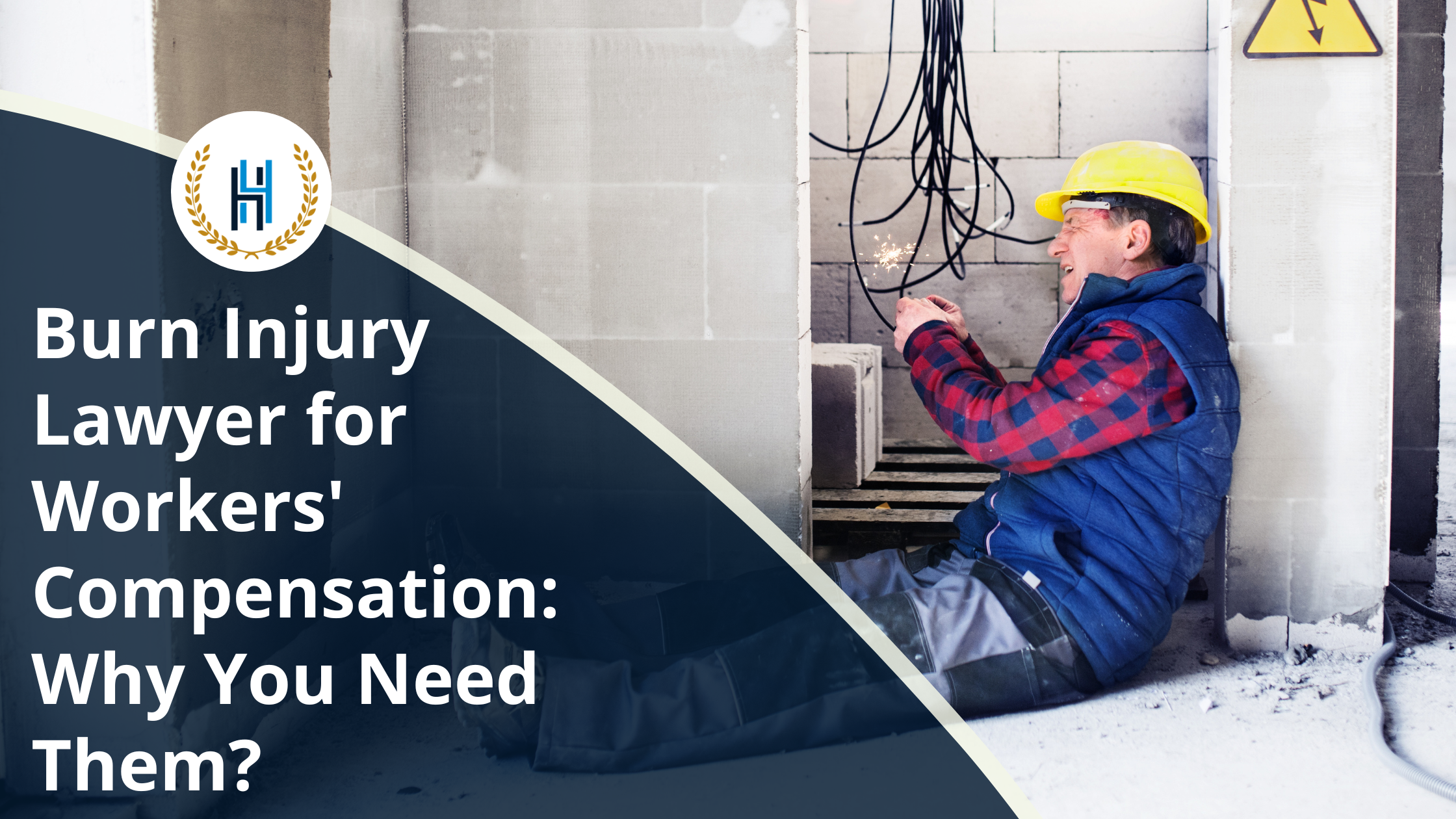 Burn Injury Lawyer for Workers' Compensation Why You Need Them | 2h Law